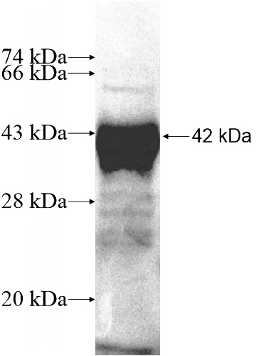 Recombinant Human ZFP28 SDS-PAGE