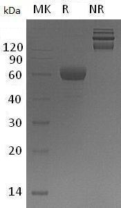 Mouse Trem2/Trem2a/Trem2b/Trem2c (Fc tag) recombinant protein
