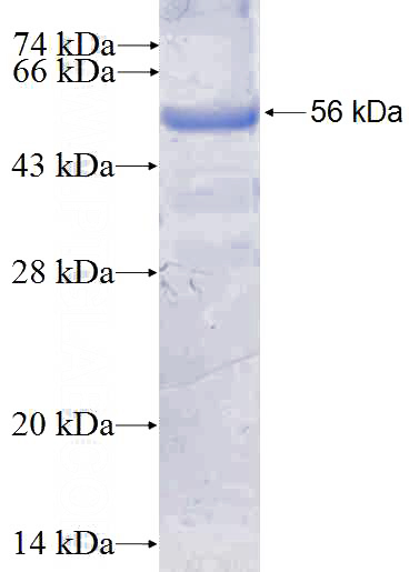 Recombinant Human SLC12A1 SDS-PAGE
