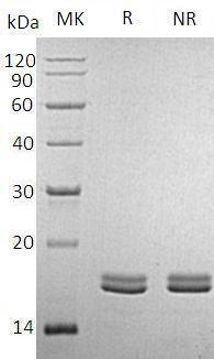 Human CD40LG/CD40L/TNFSF5/TRAP recombinant protein