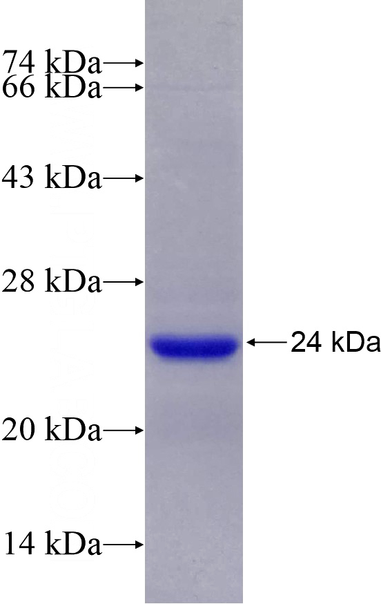 Recombinant Human CLCN2 SDS-PAGE