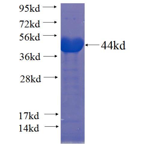 Recombinant human COPG SDS-PAGE