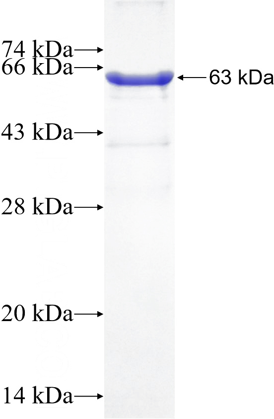 Recombinant Human DSG2 SDS-PAGE