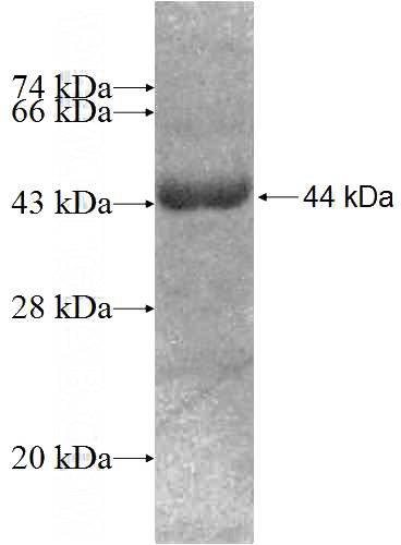 Recombinant Human UBA7 SDS-PAGE