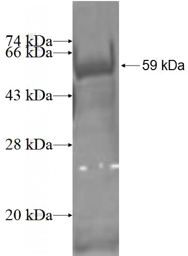Recombinant Human THADA SDS-PAGE