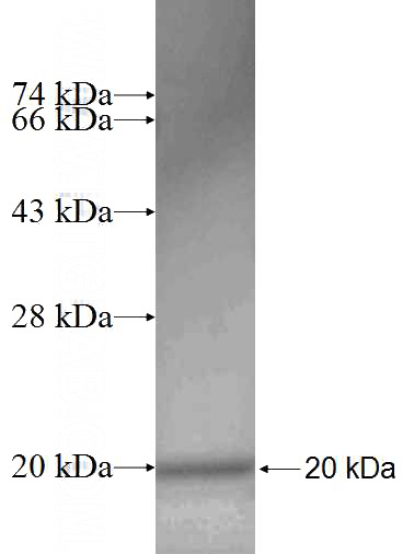 Recombinant Human SRX1 SDS-PAGE