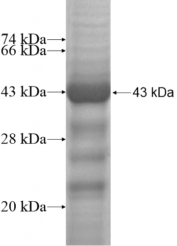 Recombinant Human CCDC94 SDS-PAGE