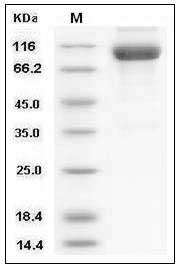 Human IL18R1 / CD218a Protein (His & Fc Tag) SDS-PAGE