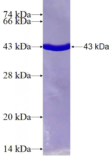 Recombinant Human ROCK2 SDS-PAGE