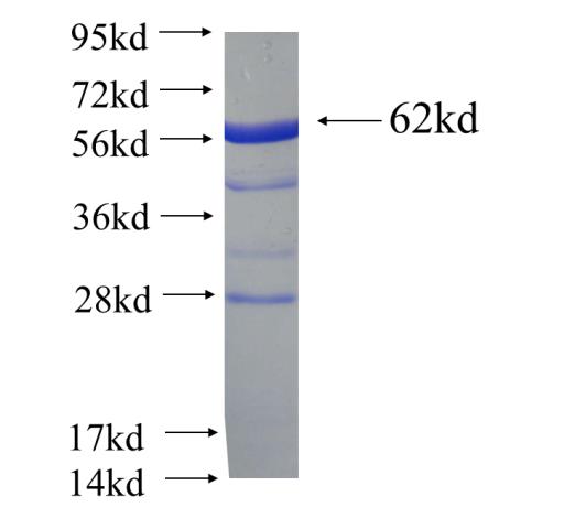 Recombinant human SLC4A4 SDS-PAGE