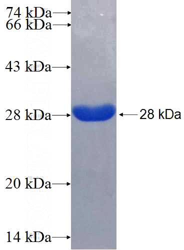 Recombinant Human CHMP1B SDS-PAGE