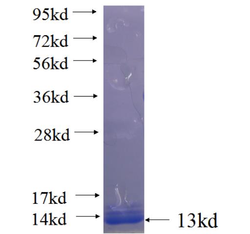 Recombinant human PIM2 SDS-PAGE