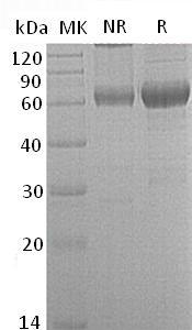 Mouse Mmp12/Mme/Mmel (His tag) recombinant protein