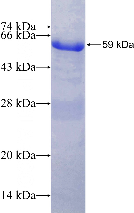 Recombinant Human PPP2R5A SDS-PAGE