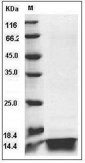 Human IL4 / Interleukin-4 Protein SDS-PAGE