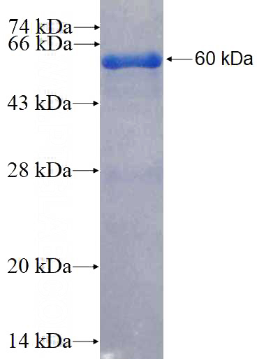 Recombinant Human PDLIM3 SDS-PAGE