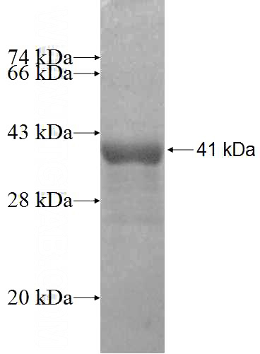Recombinant Human LRFN3 SDS-PAGE