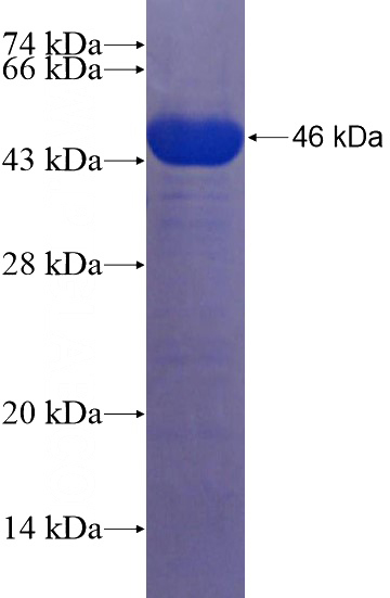 Recombinant Human ZBTB46 SDS-PAGE