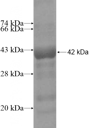 Recombinant Human SHBG SDS-PAGE