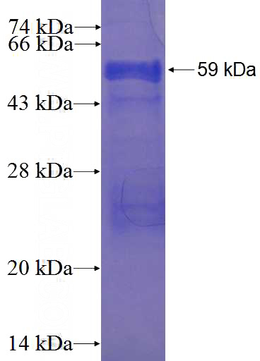 Recombinant Human IQCK SDS-PAGE