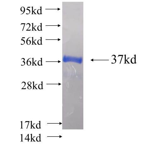 Recombinant human SNRPE SDS-PAGE
