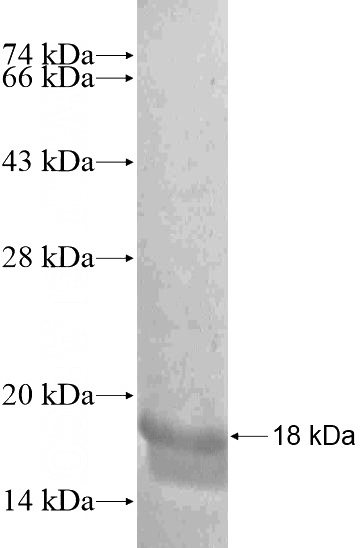 Recombinant Human L3MBTL2 SDS-PAGE