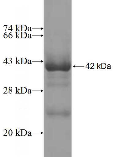 Recombinant Human NGDN SDS-PAGE
