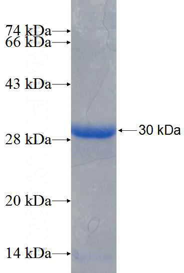 Recombinant Human CHRNB2 SDS-PAGE