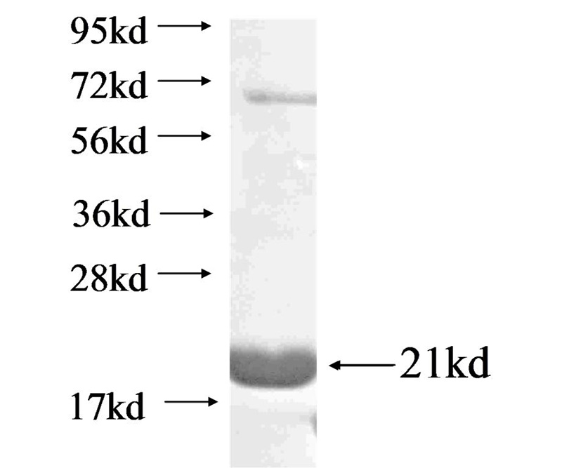 Recombinant Arabidopsis thaliana PFN1 SDS-PAGE