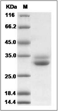 Human EPDR1 Protein (His Tag) SDS-PAGE