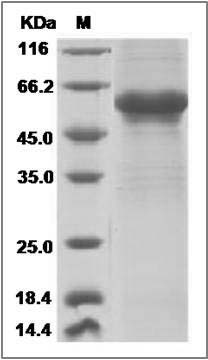 Human CGB5 Protein (Fc Tag) SDS-PAGE
