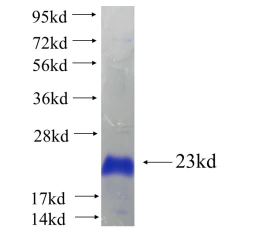 Recombinant human ZNF571 SDS-PAGE