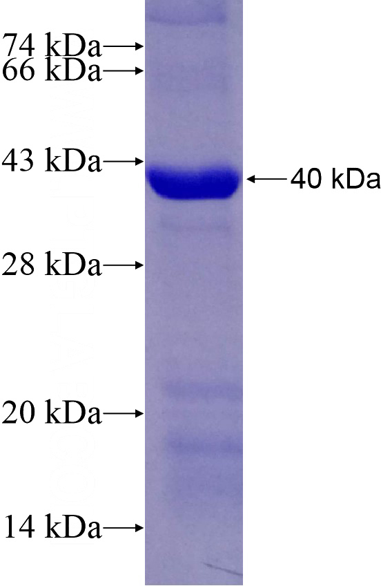 Recombinant Human TUBGCP3 SDS-PAGE