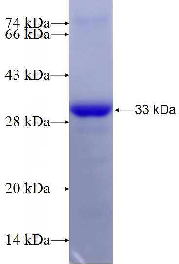 Recombinant Human YEATS4 SDS-PAGE