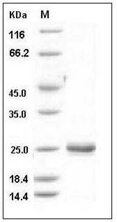 Rat LCN2 / NGAL Protein (His Tag) SDS-PAGE