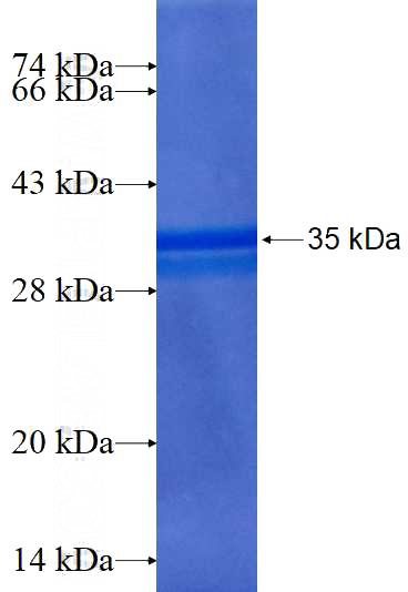 Recombinant Human MORN2 SDS-PAGE