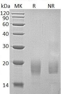 Human ACVR1B/ACVRLK4/ALK4 (His tag) recombinant protein