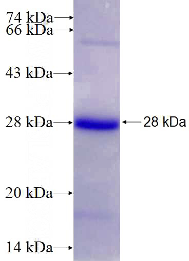 Recombinant Human HLA-DRB1 SDS-PAGE