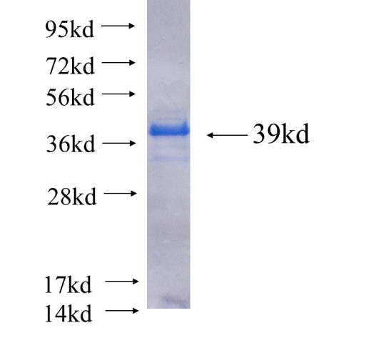 Recombinant human SLC39A4 SDS-PAGE