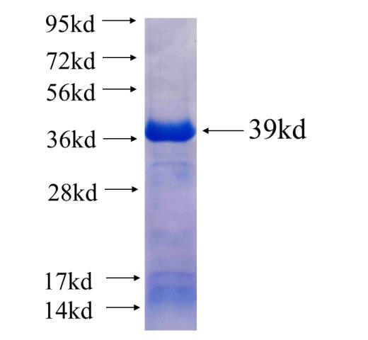 Recombinant human UGT2B7 SDS-PAGE