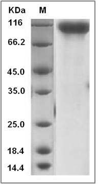 Mouse HER4 / ErbB4 Protein (His Tag) SDS-PAGE