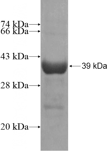 Recombinant Human FAM49B SDS-PAGE