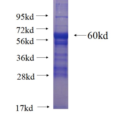 Recombinant human SPATS1 SDS-PAGE