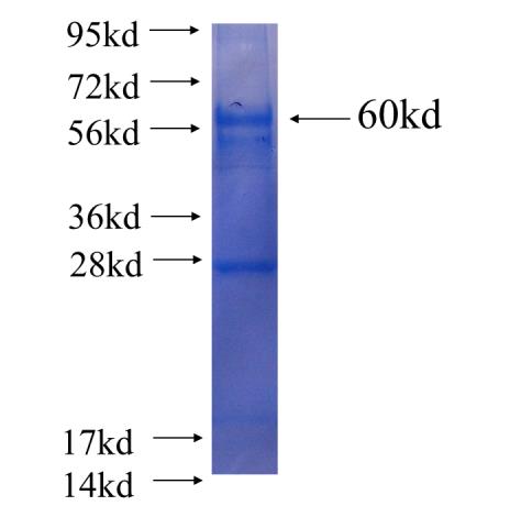 Recombinant human HEMGN SDS-PAGE