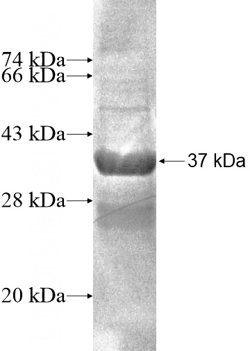 Recombinant Human OTOR SDS-PAGE