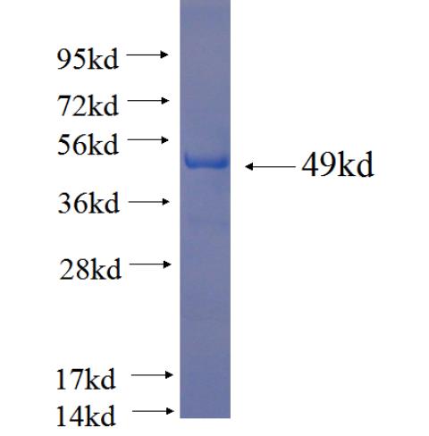 Recombinant human NAP1L4 SDS-PAGE