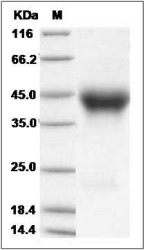 Cynomolgus IL2RA Protein (His Tag) SDS-PAGE