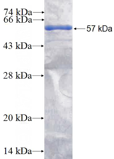 Recombinant Human Porin SDS-PAGE
