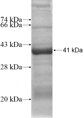 Recombinant Human TECPR2 SDS-PAGE