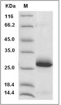 Rat Ephrin-A1/EFNA1 (His Tag) recombinant protein